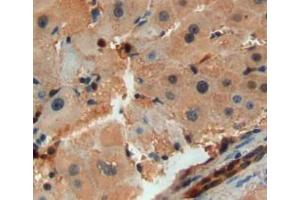 Used in DAB staining on fromalin fixed paraffin-embedded liver tissue (SAA2 抗体  (AA 20-122))