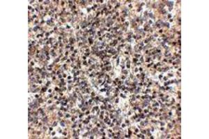 Immunohistochemistry of RSPO1 in human spleen tissue with RSPO1 polyclonal antibody  at 2. (RSPO1 抗体  (N-Term))