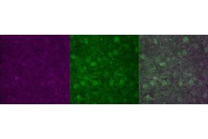 Immunohistochemistry (IHC) image for anti-Protein Phosphatase 1, Regulatory (Inhibitor) Subunit 1B (PPP1R1B) antibody (ABIN7456009) (DARPP32 抗体)