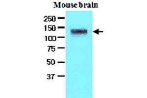 The extracts of mouse brain (50 ug) were resolved by SDS-PAGE, transferred to NC membrane and probed with EPHA2 monoclonal antibody, clone 3D7  (1:500). (EPH Receptor A2 抗体  (AA 559-976))
