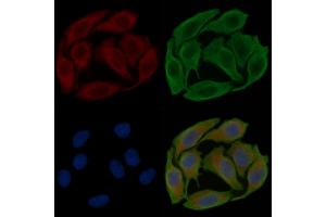 ABIN6258609 and ABIN6274191 staining Hela cells(30 min of UV treatment) by IF/ICC. (Hexokinase 1 抗体  (N-Term))