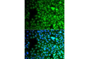 Immunofluorescence analysis of A549 cells using ZNF195 antibody (ABIN4905676). (ZNF195 抗体)