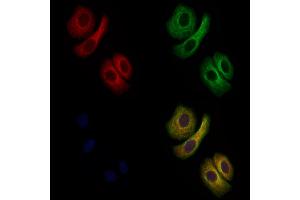 ABIN6261281 and ABIN6279354 staining Hela cells by IF/ICC.