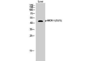 Western Blotting (WB) image for anti-Opioid Receptor, mu 1 (OPRM1) (pSer375) antibody (ABIN3173387) (Mu Opioid Receptor 1 抗体  (pSer375))