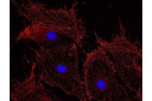 Indirect immunostaining of methanol fixed rat fibroblasts (dilution 1 : 500; red). (beta Actin 抗体)