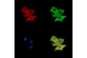 GAB3 Antibody staining HepG2 cells by IF/ICC.