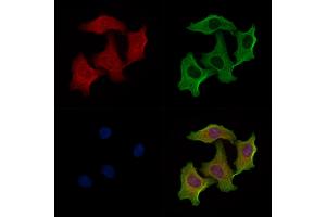 ABIN6258925 and ABIN6274995 staining Hela cells by IF/ICC. (CBLN2 抗体  (N-Term))