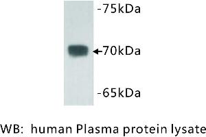 Image no. 1 for anti-Complement C3 beta Chain (C3b) antibody (ABIN1112803) (Complement C3b 抗体)