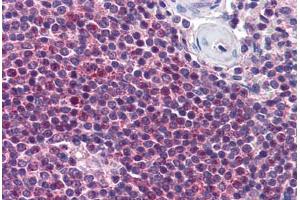 Human Spleen (formalin-fixed, paraffin-embedded) stained with NIACR2 antibody ABIN290337 at 10 ug/ml followed by biotinylated goat anti-rabbit IgG secondary antibody ABIN481713, alkaline phosphatase-streptavidin and chromogen. (GPR109B 抗体  (AA 1-50))