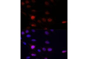 Immunofluorescence analysis of C6 cells using KLHL8 antibody (ABIN7268081) at dilution of 1:100. (KLHL8 抗体  (AA 271-620))