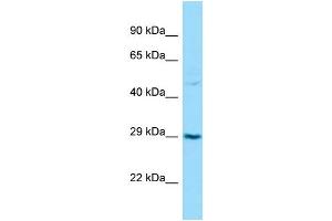 Western Blotting (WB) image for anti-Transforming Growth Factor beta Regulator 1 (TBRG1) (C-Term) antibody (ABIN2788524) (TBRG1 抗体  (C-Term))