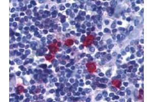 Immunohistochemistry (Paraffin-embedded Sections) (IHC (p)) image for anti-Tumor Necrosis Factor Receptor Superfamily, Member 13C (TNFRSF13C) (C-Term) antibody (ABIN499403)