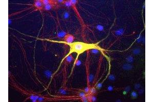 Immunostaining of cultured rat neurons and glia showing peripherin in green and alpha-internexin in red. (Peripherin 抗体)