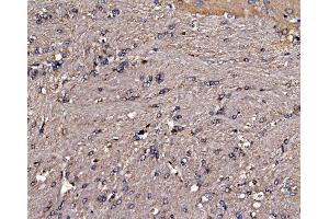 IHC analysis of Gephyrin/GPHN using anti-Gephyrin/GPHN antibody (ABIN7600086). (Gephyrin 抗体  (AA 148-736))