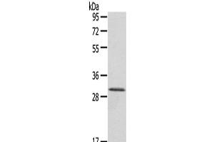 Western Blot analysis of A431 cells using HTATIP2 Polyclonal Antibody at dilution of 1/800 (HIV-1 Tat Interactive Protein 2, 30kDa (HTATIP2) 抗体)
