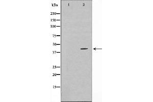 Western blot analysis on COLO205 cell lysate using TBX1 Antibody. (T-Box 1 抗体  (C-Term))