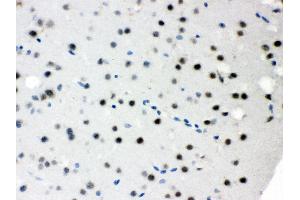 Anti- SNRPN Picoband antibody, IHC(P) IHC(P): Mouse Brain Tissue (SNRPN 抗体  (N-Term))