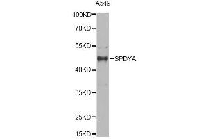 Western blot analysis of extracts of A549 cells, using SPDYA antibody. (SPDYA 抗体)