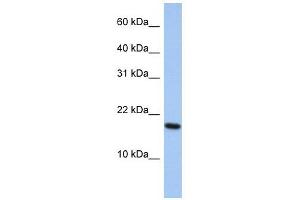 ARL5A antibody used at 1 ug/ml to detect target protein. (ARL5A 抗体  (Middle Region))