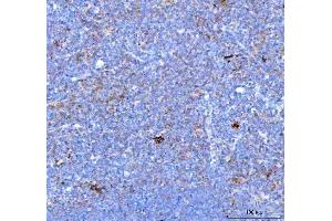IHC analysis of PDCD1 using anti PDCD1 antibody (ABIN5518784). (PD-1 抗体  (N-Term))