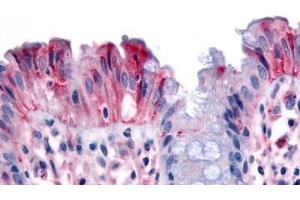 Human Colon, Surface Epithelium (formalin-fixed, paraffin-embedded) stained with MST1R antibody ABIN213539 at 3 ug/ml followed by biotinylated goat anti-rabbit IgG secondary antibody ABIN481713, alkaline phosphatase-streptavidin and chromogen. (MST1R 抗体  (Internal Region))