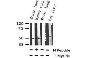 Western blot analysis of Phospho-VASP (Ser157) expression in various lysates
