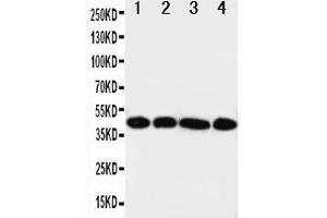 Anti-IL3RA antibody, Western blotting Lane 1: A431 Cell Lysate Lane 2: SMMC Cell Lysate Lane 3: U87 Cell Lysate Lane 4: 293T Cell Lysate (IL3RA 抗体  (Middle Region))