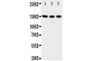 Anti-TrkC antibody, Western blotting Lane 1: Rat Brain Tissue Lysate Lane 2: Mouse Brain Tissue Lysate Lane 3: U87 Cell Lysate