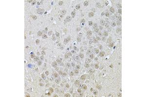 Immunohistochemistry of paraffin-embedded mouse brain using DR1 Antibody (ABIN5975441) at dilution of 1/100 (40x lens). (DR1 抗体)