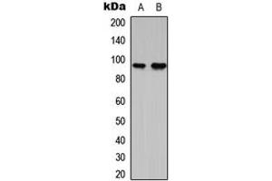 Western blot analysis of G15 expression in RT4 (A), NIH3T3 (B) whole cell lysates. (AGPAT1 抗体  (Center))