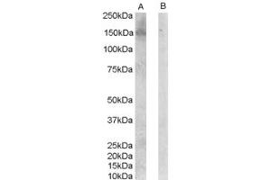 Western Blotting (WB) image for anti-Centrosomal Protein 70kDa (CEP70) (N-Term) antibody (ABIN2787764) (CEP70 抗体  (N-Term))