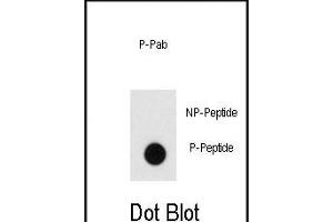 Dot blot analysis of anti-Phospho-Endophilin-pY80 Pab (ABIN650823 and ABIN2839797) on nitrocellulose membrane. (Endophilin (pTyr80) 抗体)