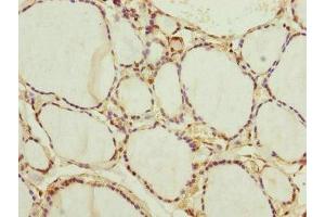 Immunohistochemistry of paraffin-embedded human thyroid tissue using ABIN7165859 at dilution of 1:100 (NEDD1 抗体  (AA 411-660))