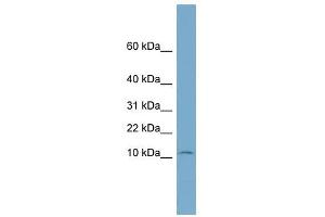 NOLA3 antibody used at 1 ug/ml to detect target protein. (Nop10 抗体  (Middle Region))