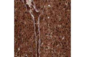 Immunohistochemical staining of human liver with FTSJ1 polyclonal antibody  shows strong nuclear and cytoplasmic positivity in hepatocytes and extracellular positivity in blood vessels . (FTSJ1 抗体)