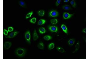 Immunofluorescence staining of A549 cells with ABIN7147047 at 1:33, counter-stained with DAPI. (IGF2R 抗体  (AA 2328-2491))