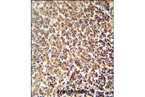 ZNF98 antibody immunohistochemistry analysis in formalin fixed and paraffin embedded human lymphnode followed by peroxidase conjugation of the secondary antibody and DAB staining. (ZNF98 抗体  (C-Term))