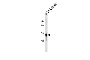 TPD52L3 Antibody (N-term) (ABIN1881899 and ABIN2843497) western blot analysis in MDA-M cell line lysates (35 μg/lane). (TPD52L3 抗体  (N-Term))