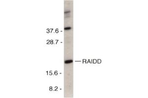 Image no. 2 for anti-CASP2 and RIPK1 Domain Containing Adaptor with Death Domain (CRADD) (C-Term) antibody (ABIN201312) (CRADD 抗体  (C-Term))