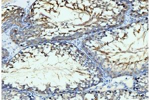 anti-GIT1 (GIT1) (AA 415-736) antibody