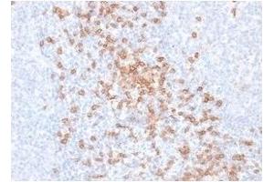 ABIN6383871 to CD8a was successfully used to stain T cells of in human tonsil sections. (Recombinant CD8 alpha 抗体)