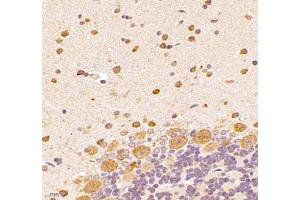 Immunohistochemistry of paraffin embedded rat epencephalon using UQCC (ABIN7076094) at dilution of 1: 1000 (400x lens)