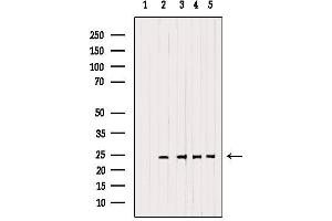 Western blot analysis of extracts from various samples, using RAB14 Antibody. (RAB14 抗体  (C-Term))