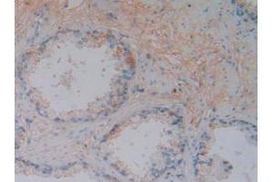 IHC-P analysis of Human Prostate Gland Tissue, with DAB staining. (Vitamin D-Binding Protein 抗体  (AA 395-474))