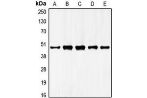 Western blot analysis of GATA4 expression in HepG2 (A), NIH3T3 (B), mouse liver (C), rat liver (D), rat kidney (E) whole cell lysates. (GATA4 抗体  (Center))