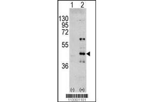 Western blot analysis of MAPK3 using rabbit polyclonal MAPK3 Antibody (Y204) using 293 cell lysates (2 ug/lane) either nontransfected (Lane 1) or transiently transfected with the MAPK3 gene (Lane 2). (ERK1 抗体  (AA 182-211))