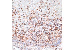 Immunohistochemistry of paraffin-embedded human esophageal using MRPL46 antibody (ABIN7268574) at dilution of 1:100 (40x lens). (MRPL46 抗体  (AA 1-279))