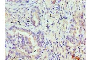 Immunohistochemistry (IHC) image for anti-Transient Receptor Potential Cation Channel, Subfamily M, Member 8 (TRPM8) (AA 980-1104) antibody (ABIN7172874)