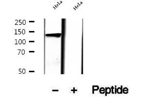 Western blot analysis of extracts of HeLa cells, using LRPPRC antibody. (LRPPRC 抗体  (Internal Region))