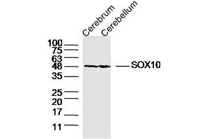 Lane 1: Mouse Cerebrum lysates Lane 2: Mouse Cerebellum lysates probed with SOX10 Polyclonal Antibody, Unconjugated  at 1:300 dilution and 4˚C overnight incubation. (SOX10 抗体  (AA 201-300))